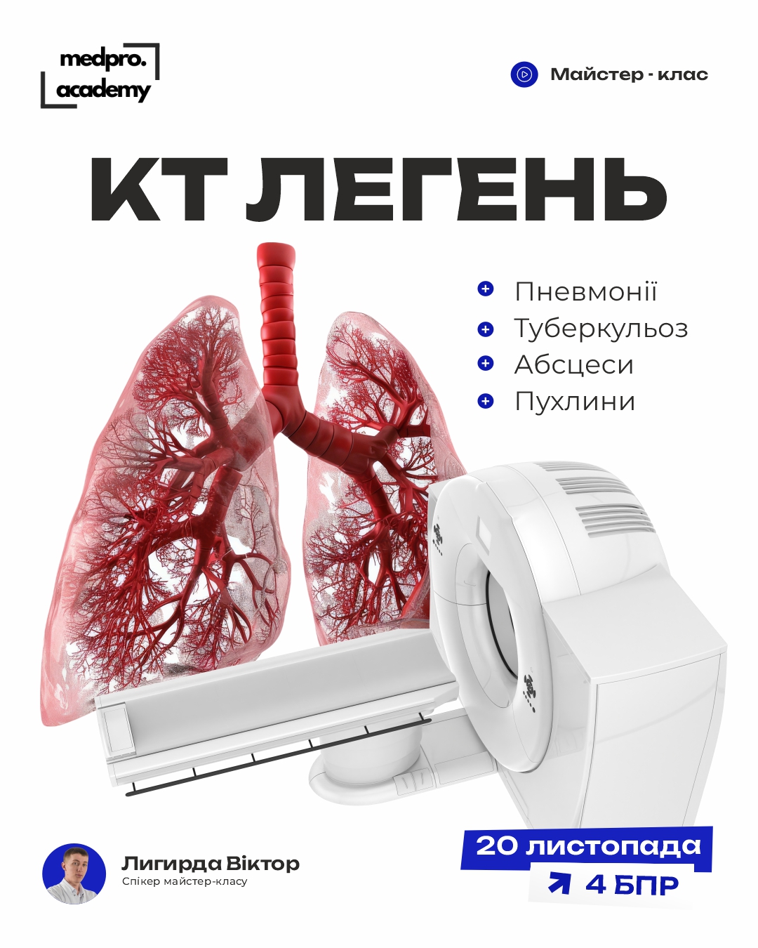 3Комп’ютерна томографія захворювань легень запальні процеси та пухлинні ураження
